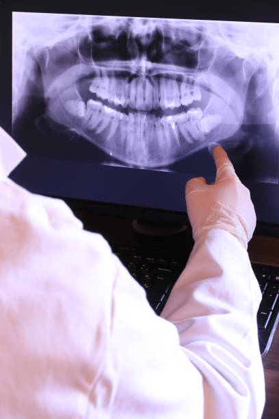 Best Root Canal Emergency Dentist  in Montgomery, TX